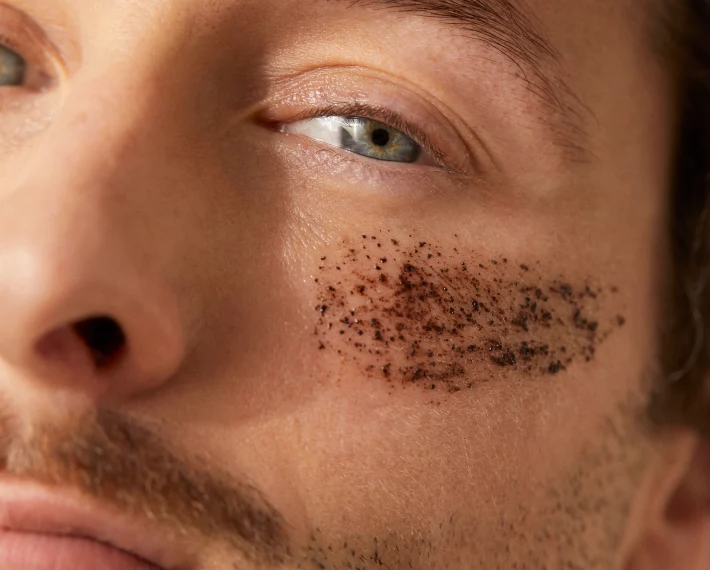 Grain de beauté avec poil poireau : ce qu&rsquo;il faut savoir en 2025